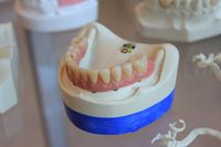 Голямо разнообразие Брекети цена 50 от The Smile Company Голямо разнообразие Брекети цена 50