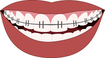 Offers for Dental Implants 22 from Confident Offers for Dental Implants 22