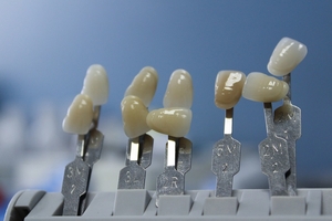 Leaders Dental Implants Bulgaria 25