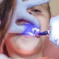 Типове ортодонт 15 от MedicalDent Типове ортодонт 15