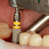 Огромно разнообразие от ортодонт 35 от MedicalDent Огромно разнообразие от ортодонт 35