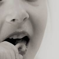 Типове ортодонт 5 от MedicalDent Типове ортодонт 5