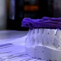 Типове пародонтологична профилактика 17 от MedicalDent Типове пародонтологична профилактика 17