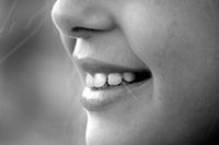 Повече за поставяне на фасети 21 от The Smile Company Повече за поставяне на фасети 21