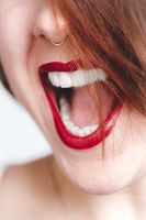 Информация за Поставяне на фасети софия 18 от The Smile Company Информация за Поставяне на фасети софия 18