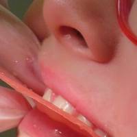 Информация за възпаление на венците 10 от MedicalDent Информация за възпаление на венците 10
