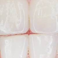 Невероятни зъбни протези 29