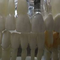 Изключително добри зъбни протези 5