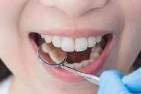 зъболекар русе - 23504 - научете повече
