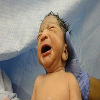 стволови клетки от пъпна връв - 39148 отстъпки стволови клетки от пъпна връв - 96180 отстъпки
