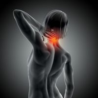ишиас - 8251 отстъпки ишиас - 85675 отстъпки