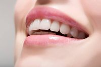 Invisalign - 43170 постижения Invisalign - 33927 постижения