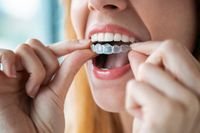 Invisalign - 77760 вида Invisalign - 68078 вида