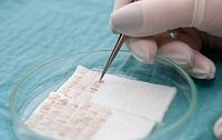 уголемяване на бюст - 28392 отстъпки