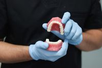 ленти за избелване на зъби - 10814 постижения | Dentalcare ленти за избелване на зъби - 38012 постижения