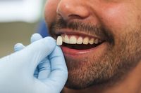 пародонтит - 2328 селекции | Dentalcare пародонтит - 41888 селекции