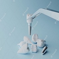 циркониева коронка цена - 85297 бестселъри циркониева коронка цена - 33727 бестселъри