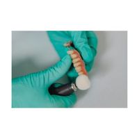 почистване на зъбен камък Варна - 14578 новини | Dental Club почистване на зъбен камък Варна - 61080 новини