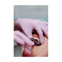 ретиниран мъдрец - 32522 оферти | Dental Club ретиниран мъдрец - 72317 оферти