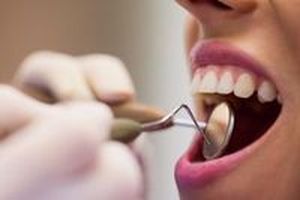 бондинг на зъби - 44067 постижения | Supreme Dental бондинг на зъби - 84532 постижения