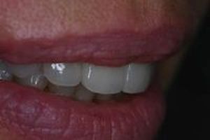 дентална клиника софия - 87740 предложения | Supreme Dental дентална клиника софия - 73455 предложения
