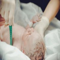 Стволови клетки от пъпна връв - 98203 възможности Стволови клетки от пъпна връв - 76059 възможности